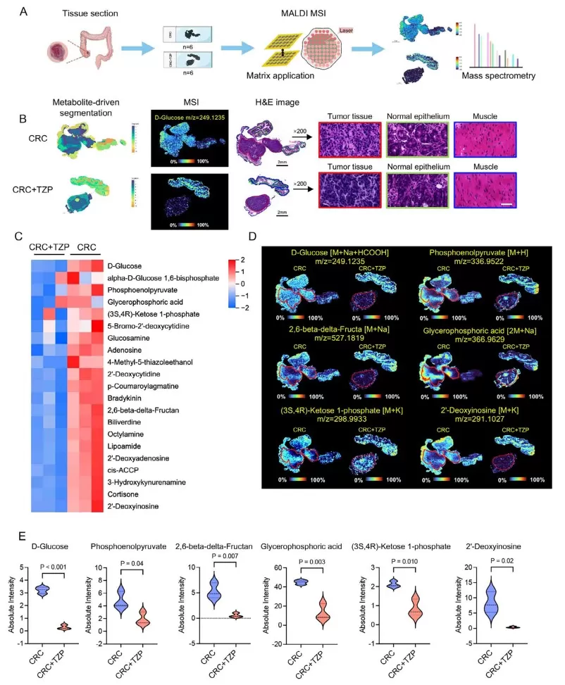 Spatial metabolomics profiled shows that TZP reduced glycolysis in the colon cancer tissues.